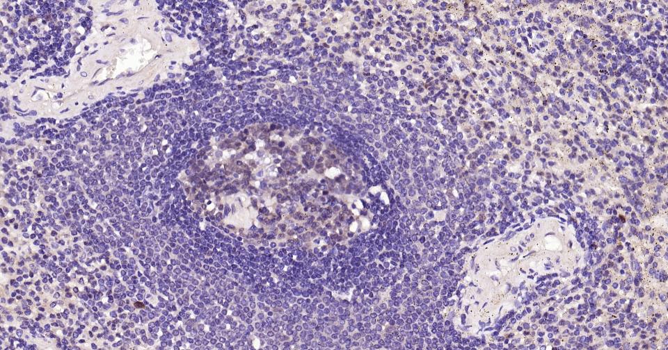 半胱胺酸蛋白酶蛋白-3抗体-bs-55032R