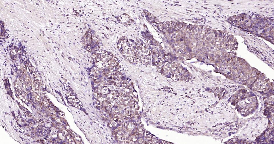 基质金属蛋白酶-12重组兔单抗