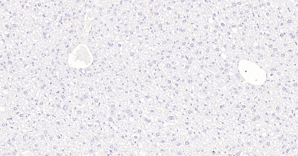 酪氨酸激酶B重组兔单抗