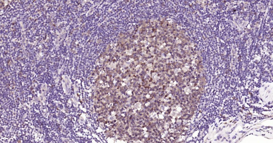 半胱胺酸蛋白酶蛋白-3抗体-bs-55032R