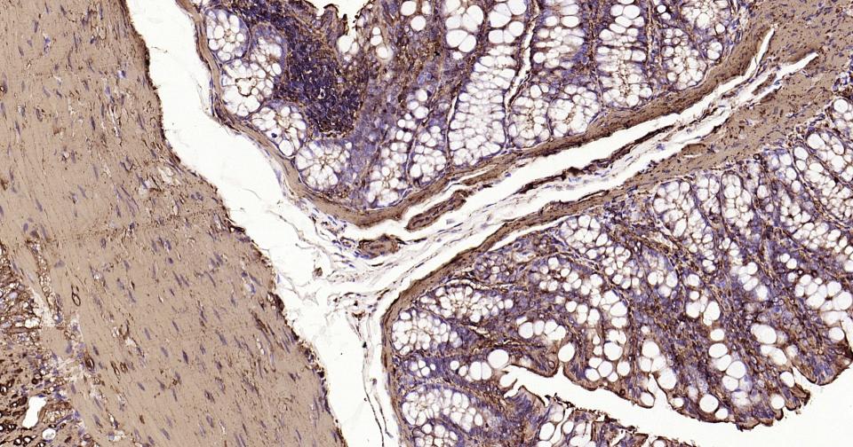 α-SMA重组兔单抗