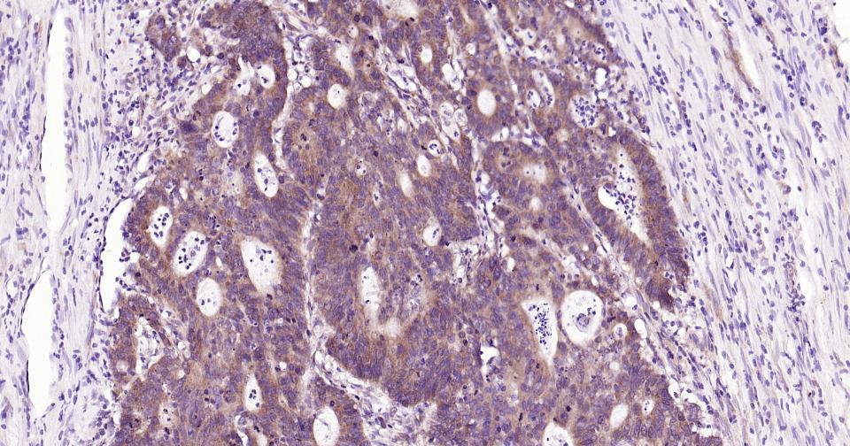 基质金属蛋白酶-12重组兔单抗