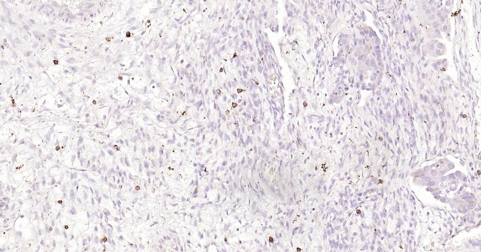 原癌基因蛋白c-kit(CD117)重组兔单抗