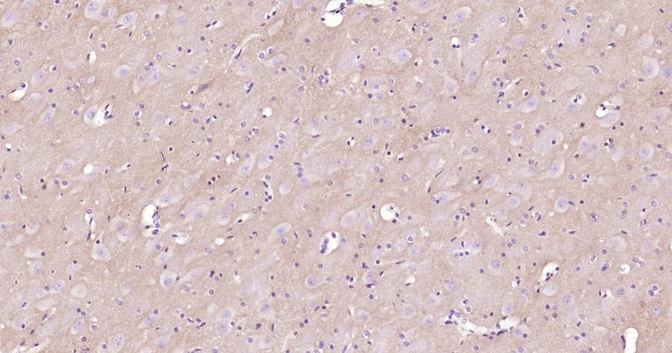 酪氨酸激酶B重组兔单抗