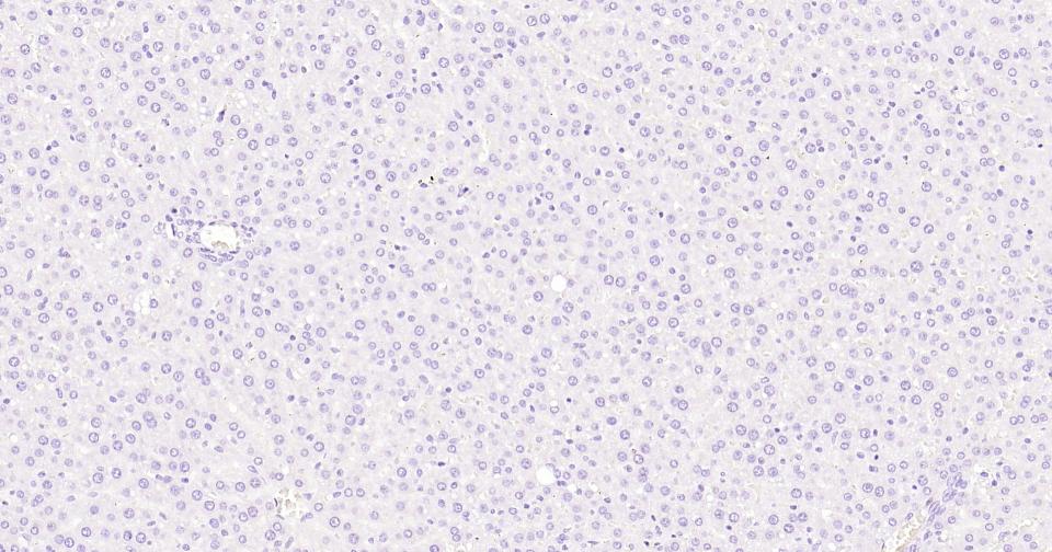 酪氨酸激酶B重组兔单抗