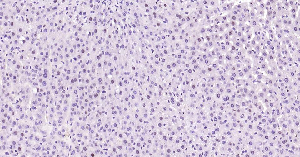 周期素D1重组兔单抗