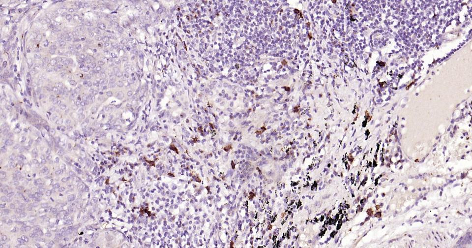 原癌基因蛋白c-kit(CD117)重组兔单抗