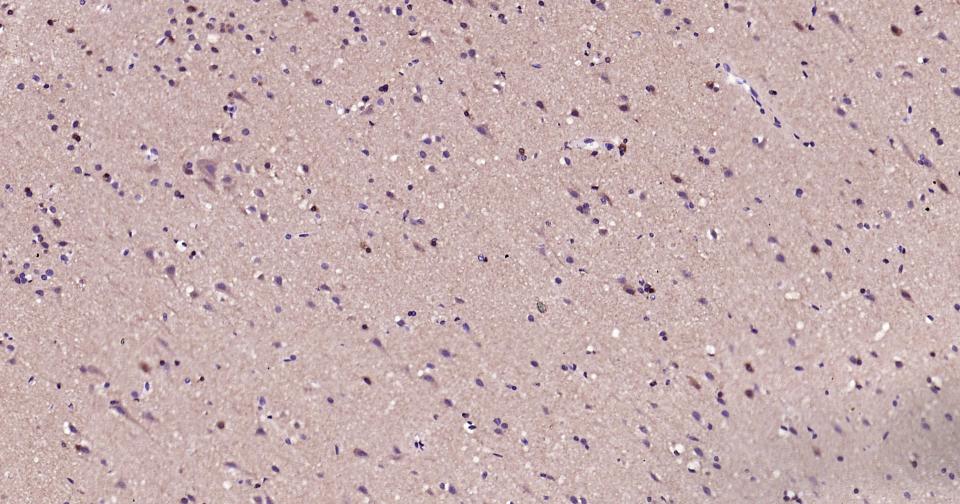 线粒体促凋亡蛋白重组兔单抗