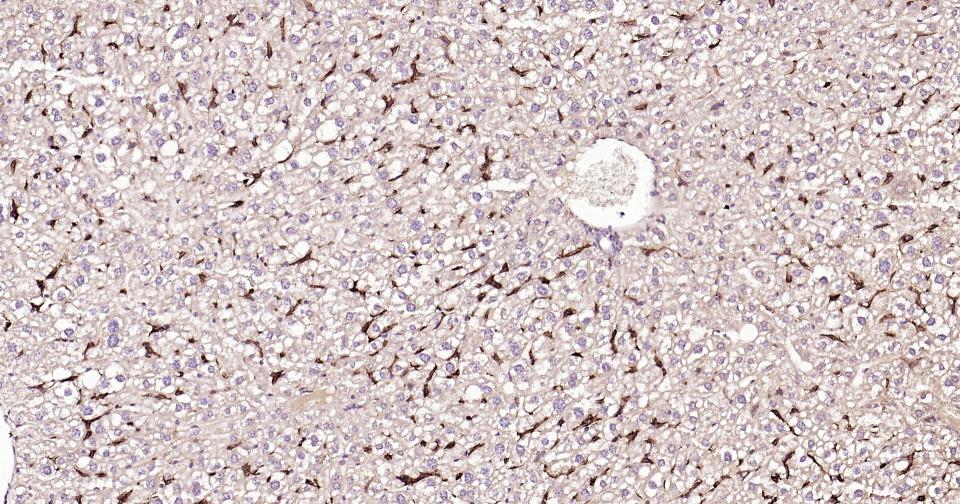 ADGRE1 Rabbit pAb (一抗) - IHC-P,IHC-F,IF | Bioss