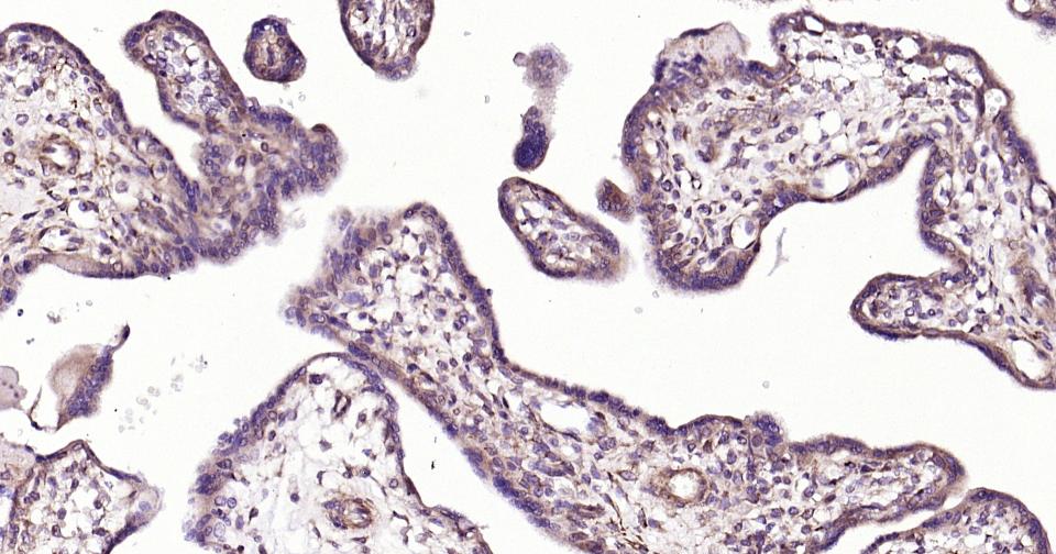 基质金属蛋白酶-12重组兔单抗