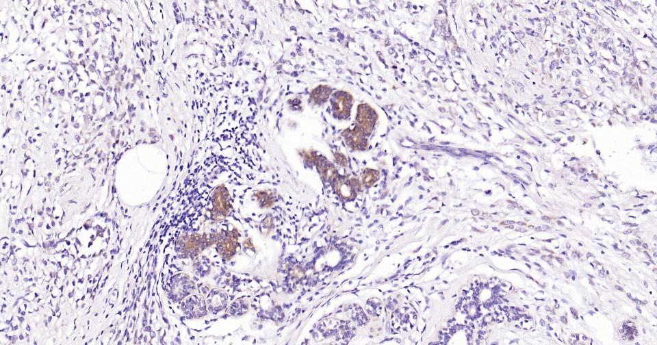 线粒体促凋亡蛋白重组兔单抗