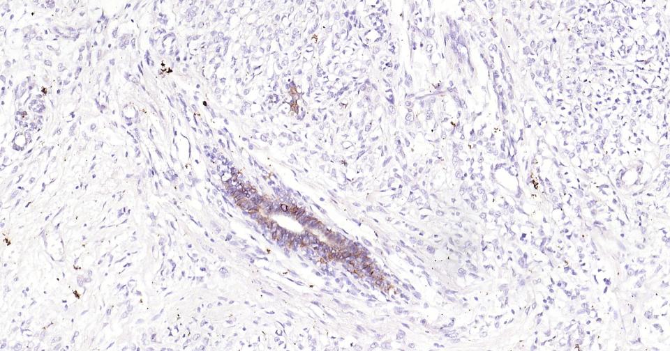 原癌基因蛋白c-kit(CD117)重组兔单抗