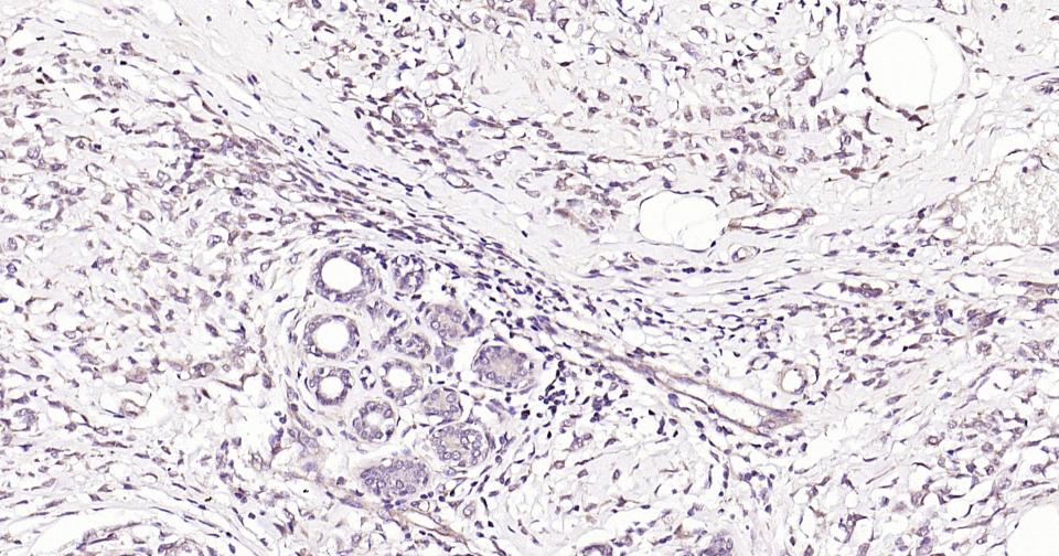 基质金属蛋白酶-12重组兔单抗