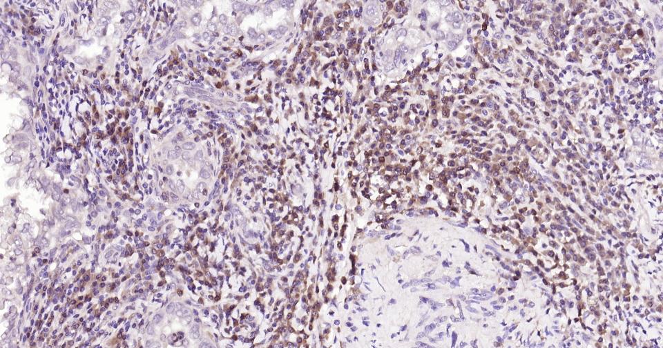 半胱胺酸蛋白酶蛋白-3抗体-bs-55032R