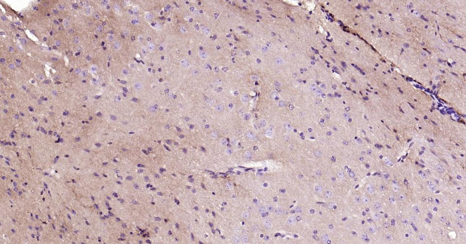 酪氨酸激酶B重组兔单抗