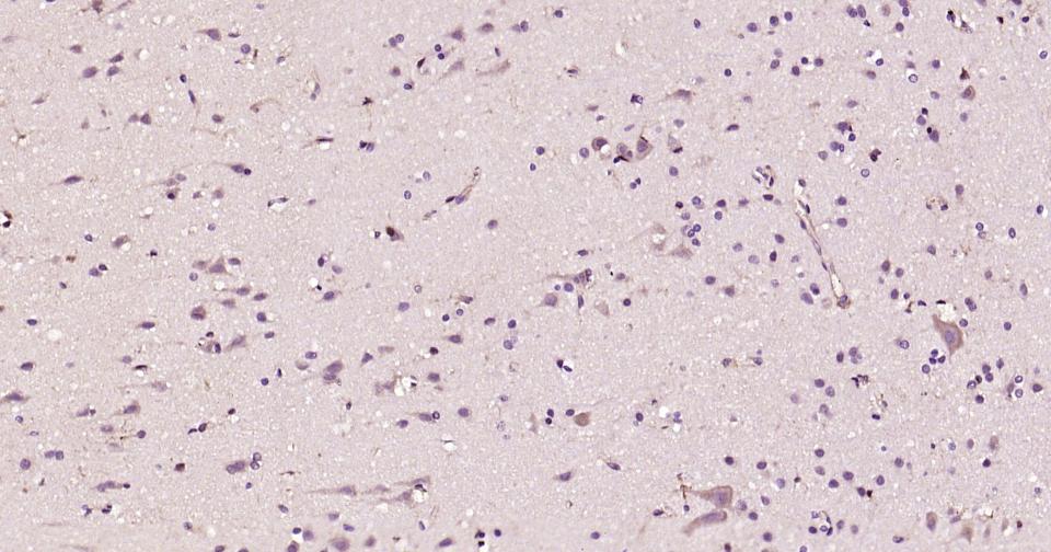 基质金属蛋白酶-12重组兔单抗