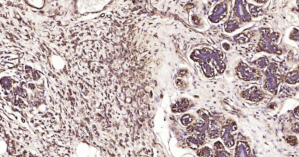 α-SMA重组兔单抗