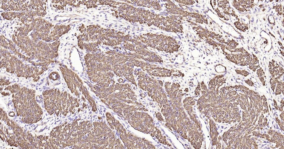 α-SMA重组兔单抗