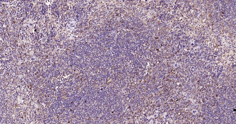 半乳糖凝集素3抗体-bs-41218R