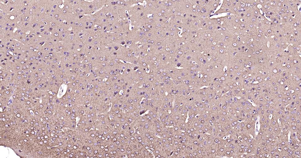 微管蛋白β3重组兔单抗