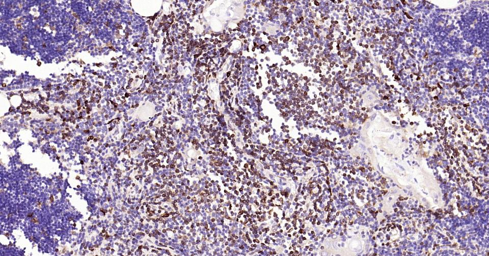 CD74重组兔单克隆抗体