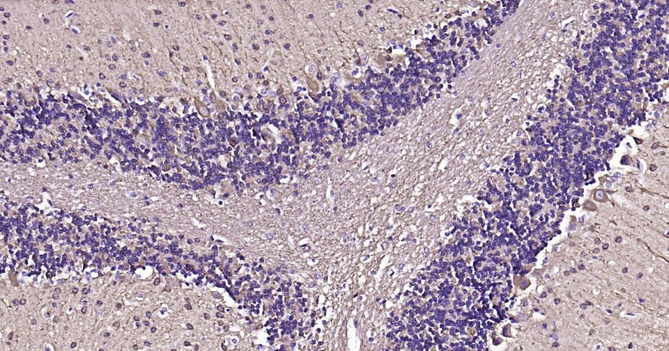 微管蛋白β3重组兔单抗