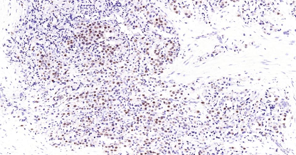 雄激素受体重组兔单抗