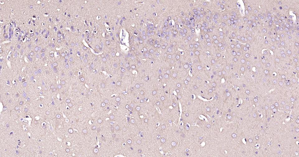 微管蛋白β3重组兔单抗