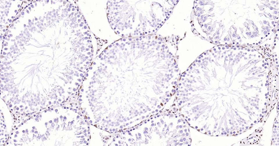 雄激素受体重组兔单抗