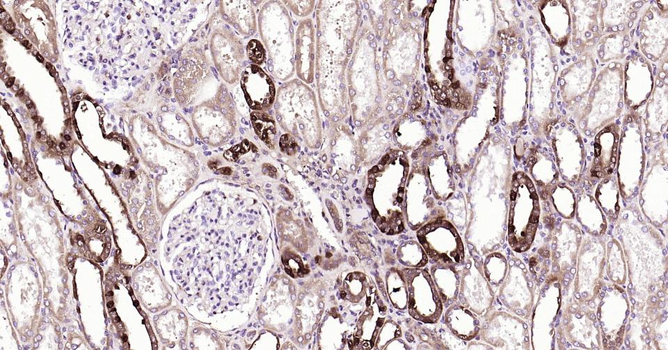 半乳糖凝集素3重组兔单抗