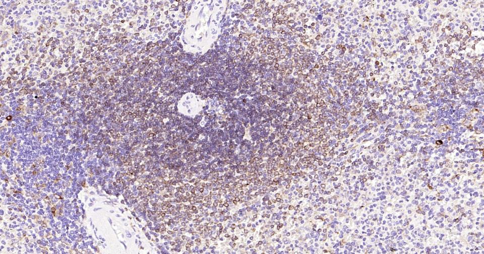 CD74重组兔单克隆抗体