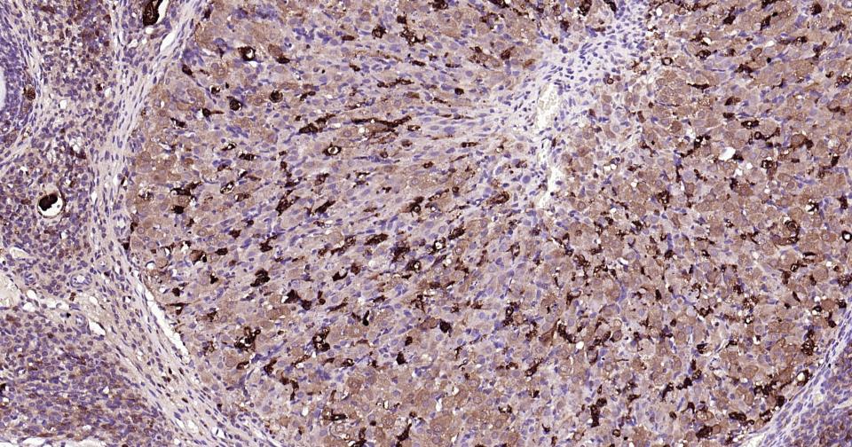 半乳糖凝集素3抗体-bs-41218R