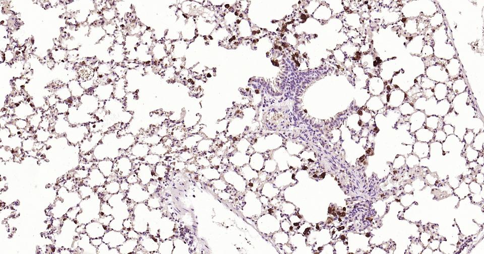 半乳糖凝集素3抗体-bs-41218R