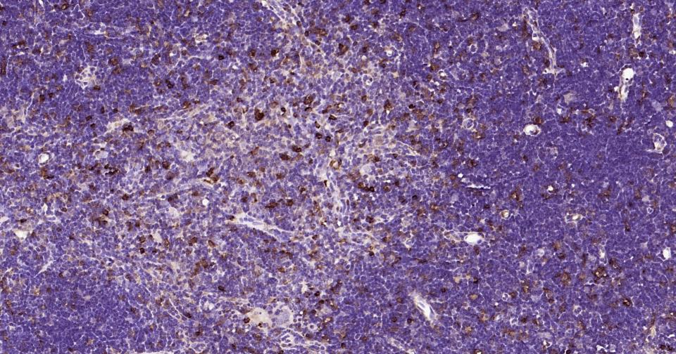 半乳糖凝集素3抗体-bs-41218R