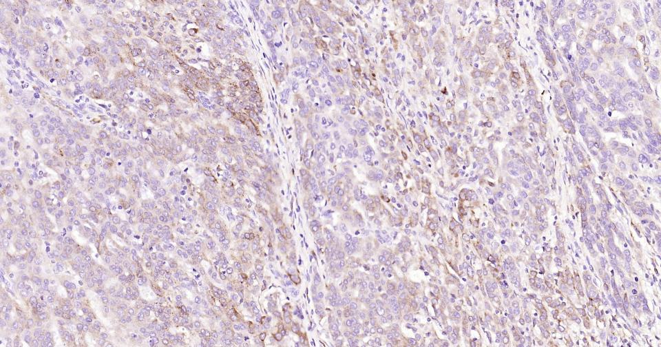 CD74重组兔单克隆抗体