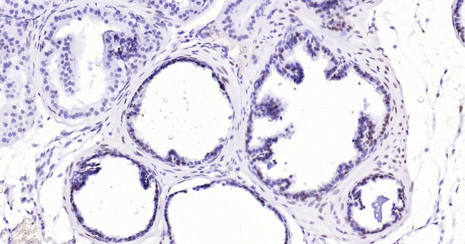 雄激素受体重组兔单抗