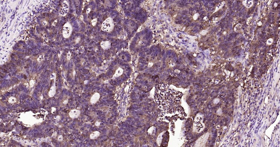 半乳糖凝集素3抗体-bs-41218R