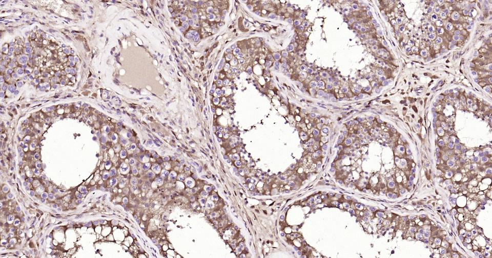 半乳糖凝集素3抗体-bs-41218R