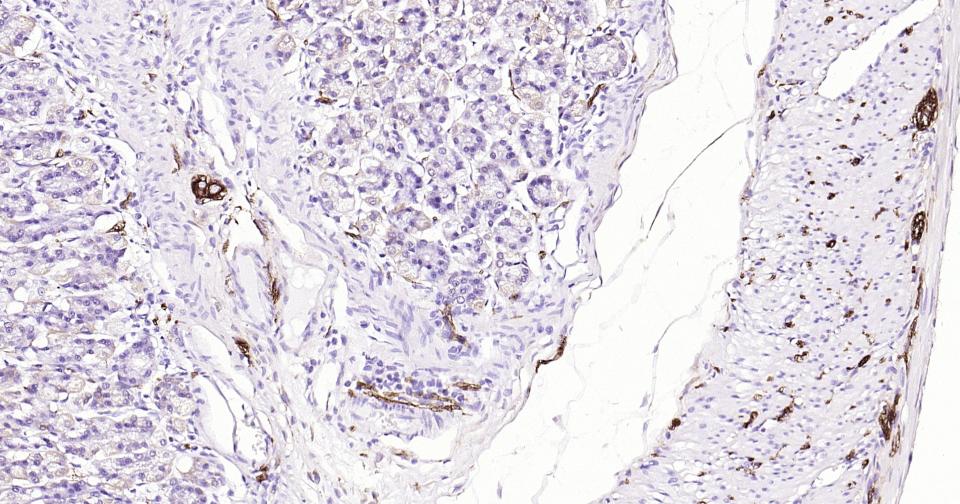 微管蛋白β3重组兔单抗