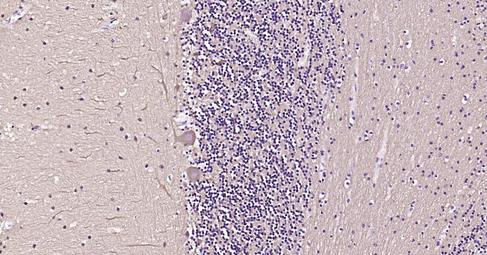 微管蛋白β3重组兔单抗