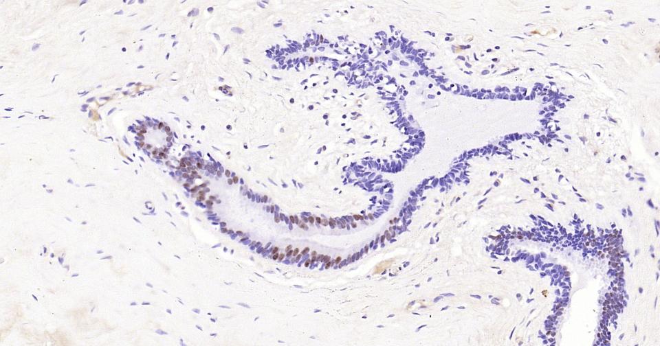 雄激素受体重组兔单抗