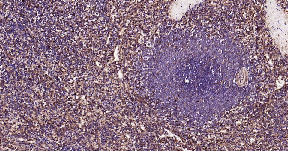 半乳糖凝集素3抗体-bs-41218R