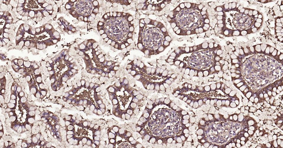 半乳糖凝集素3抗体-bs-41218R