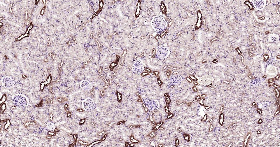 半乳糖凝集素3抗体-bs-41218R