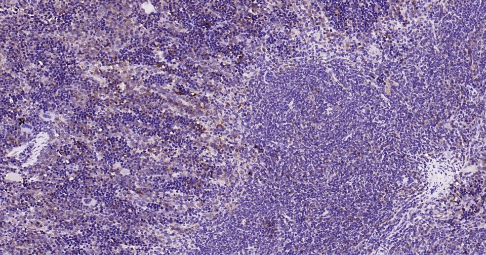 半乳糖凝集素3抗体-bs-41218R