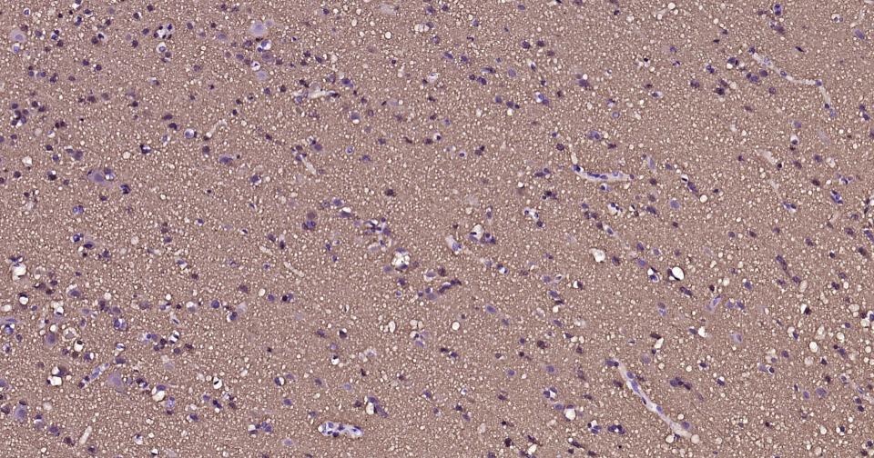 微管蛋白β3重组兔单抗