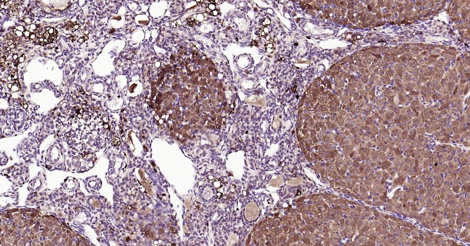 半乳糖凝集素3抗体-bs-41218R