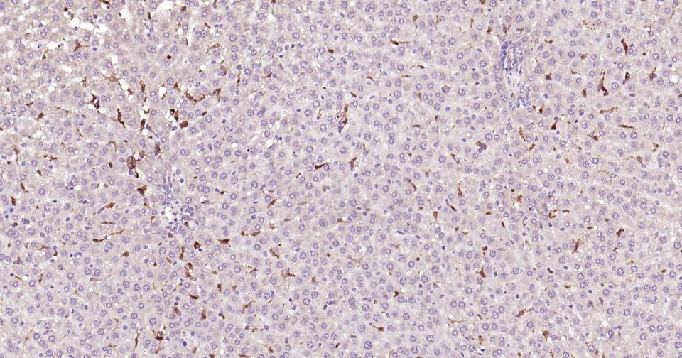 半乳糖凝集素3抗体-bs-41218R