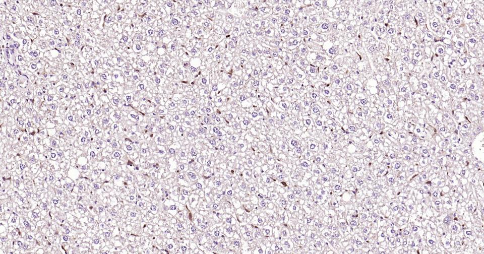 半乳糖凝集素3抗体-bs-41218R