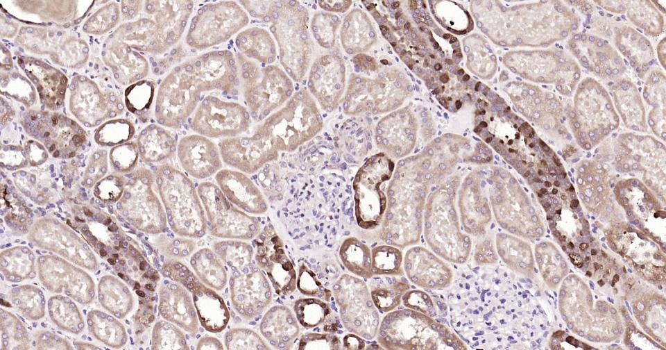 半乳糖凝集素3抗体-bs-41218R